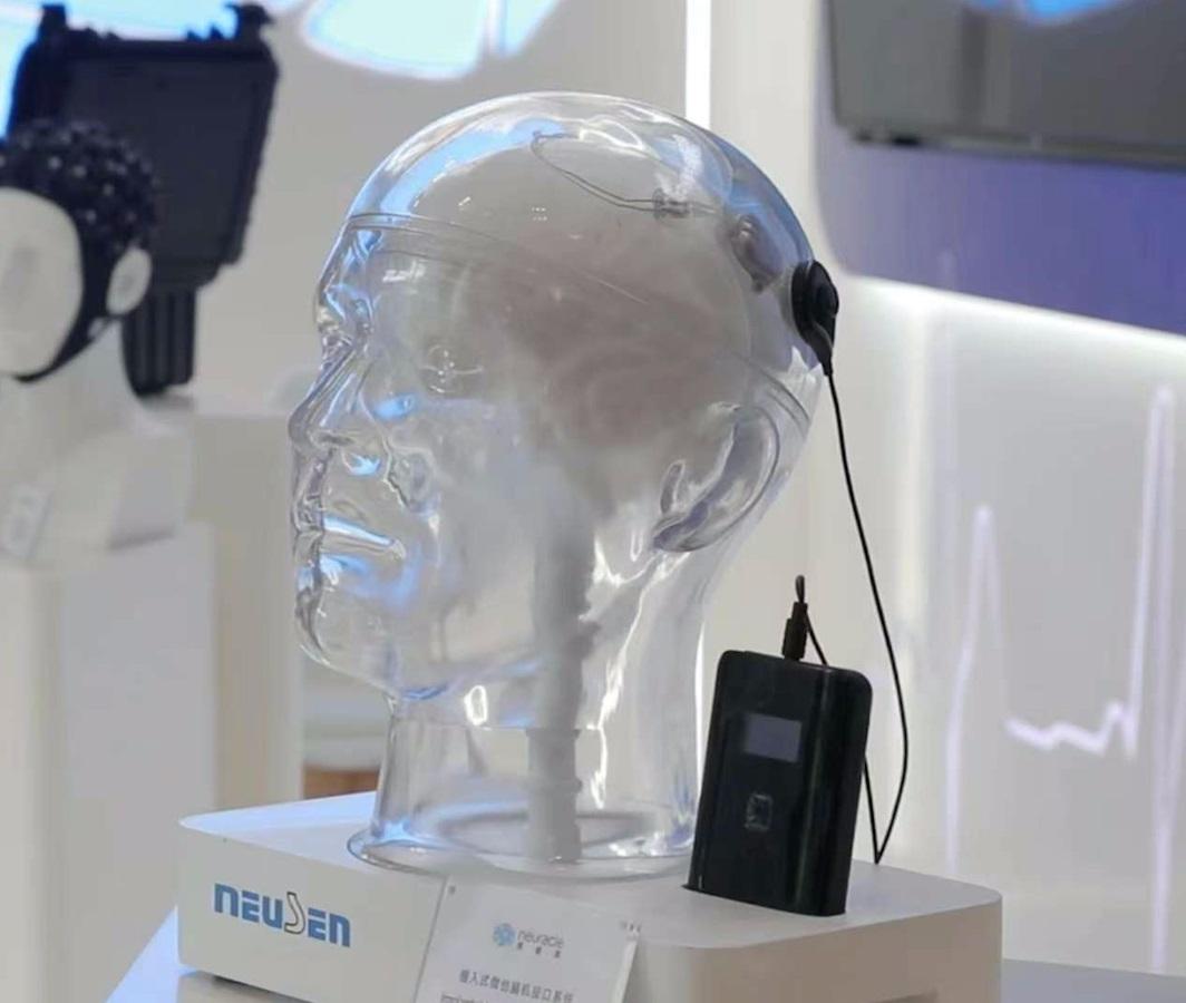 Neuralink, подвинься: в Китае впервые установили имплант в мозг реального пациента, а не в ходе испытаний