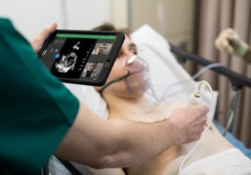 Philips Lumify превращает смартфон или планшет в прибор для медицинской ультразвуковой диагностики