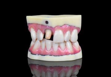 3D-принтер Stratasys J720 позволяет изготавливать реалистичные модели для стоматологии