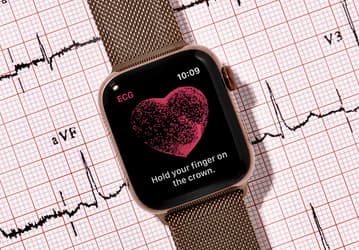 Apple Watch пробрались в систему медицинского страхования