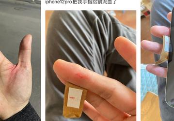 Пользователи iPhone 12 проливают кровь. Для некоторых корпус смартфона оказался слишком острым