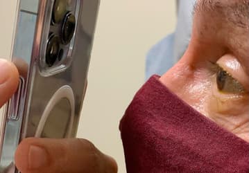 Офтальмолог уже использует макрорежим iPhone 13 Pro в своей работе