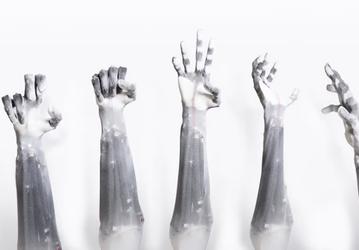 Компания Clone Robotics показала роботизированную руку с мышцами и кожей