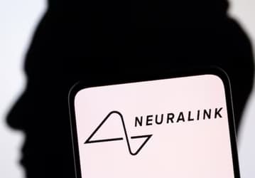 Решили ничего не менять: в Neuralink знали о проблемах с имплантатом, но всё равно вживили его в мозг человека