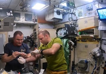 Российские космонавты проводят эксперимент «Нейроиммунитет» на МКС: замораживают свою кровь, чтобы узнать, как космос влияет на здоровье космонавтов для будущих космических миссий 
