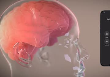 Компания Илона Маска начнёт массово чипировать людей: Neuralink планирует вживлять свои чипы 20 тысячам человек в год к 2031 году