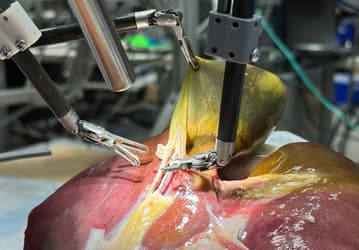Учёные Джонса Хопкинса создали робота, самостоятельно удалившего желчный пузырь на симуляторе