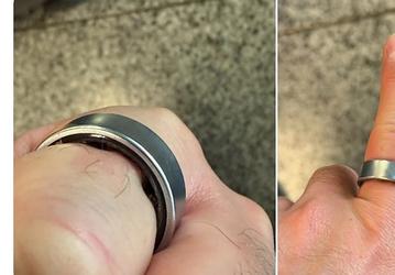 Аккумулятор Samsung Galaxy Ring вздулся, палец распух и застрял в кольце: чем всё закончилось