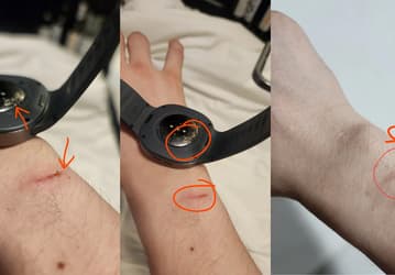 Умные часы Samsung Galaxy Watch 8 обожгли пользователя — Samsung не признала ответственность за инцидент