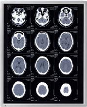 NEC LCD Technologies Announce New 19-Inch Monochrome LCD Module for Medical Use