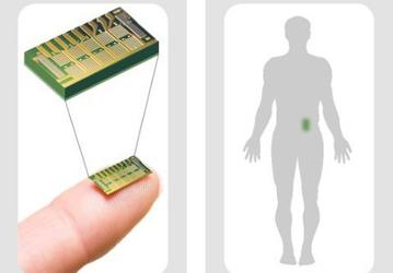 Специалисты MicroCHIPS успешно испытали на людях имплантируемый чип