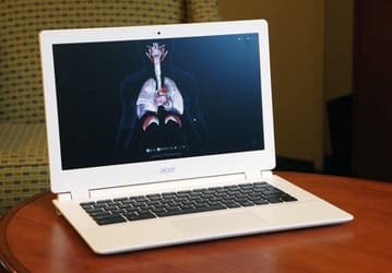 Мобильный ПК Acer Chromebook 13 (CB5-311-T7NN), основанный на SoC Tegra K1, оценён в $280