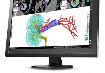 Eizo выпустила 24-дюймовый монитор для клинической диагностики RadiForce MX242W