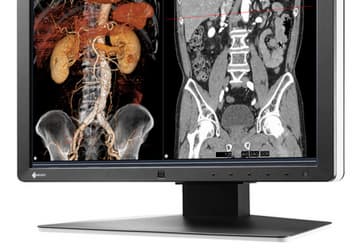 В медицинском мониторе Eizo RadiForce RX250 используется технология восстановления резкости