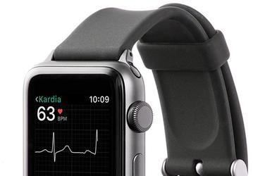 Ремешок AliveCor Kardiaband для часов Apple Watch, позволяющий получать кардиограмму, одобрен FDA 