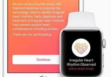 Исследование Apple Heart Study позволит разработать для умных часов лучшие алгоритмы определения нерегулярного сердечного ритма