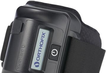 Устройства PhysioStim нехирургическим путем способствуют сращиванию костей при переломах