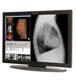 Planar Introduces 5-Megapixel Medical Display