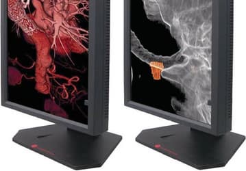Richardson Electronics выпустила два ярких и контрастных монитора высокого разрешения для медиков