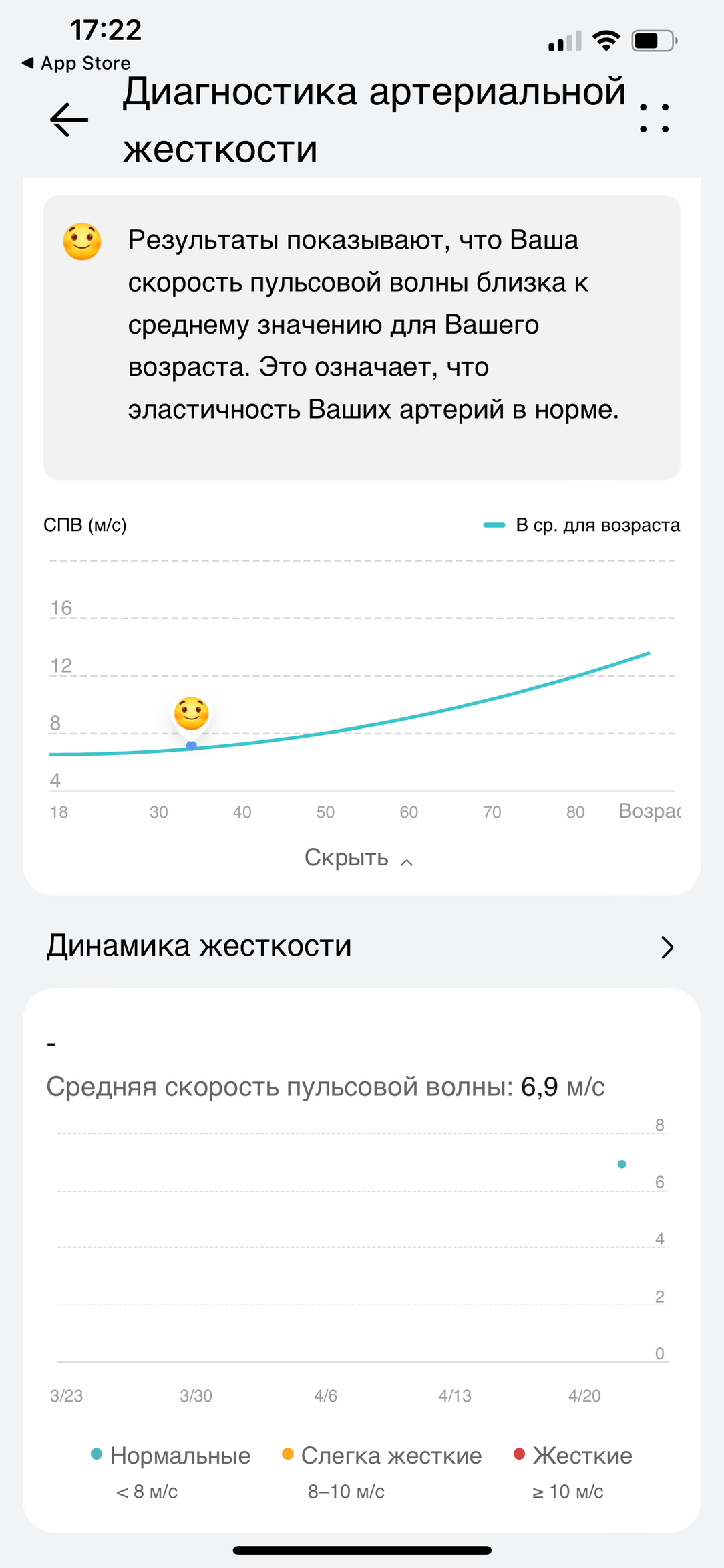 Huawei Watch Ultimate:, фото 27