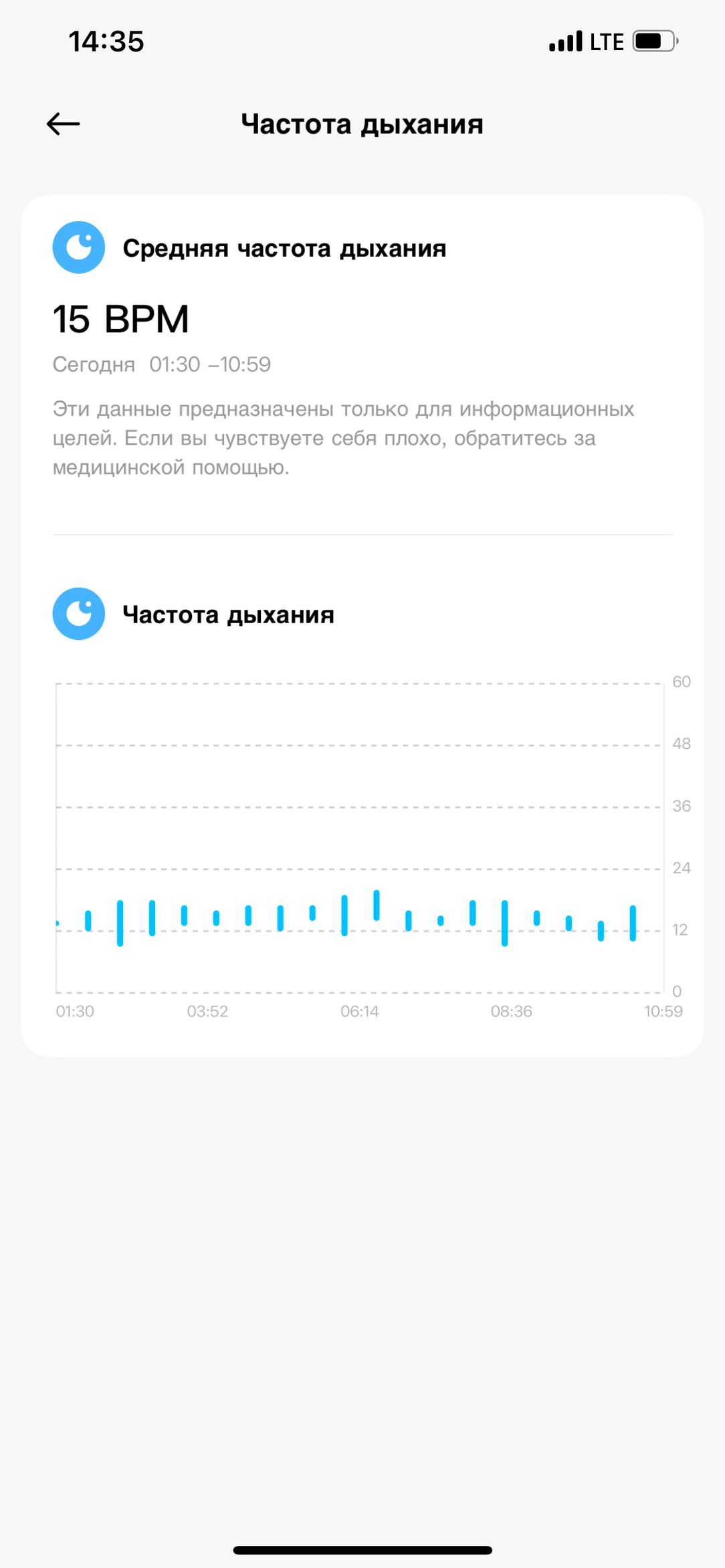 Умные часы Redmi Watch 5:, фото 18