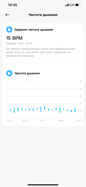 Умные часы Redmi Watch 5:, фото 18