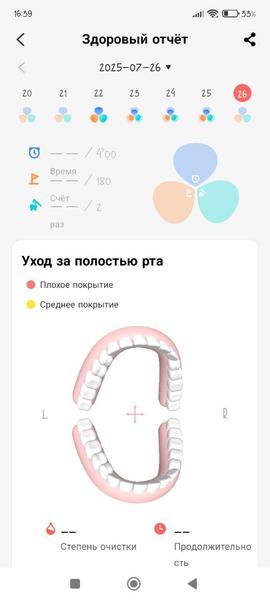 Зубная щетка Oclean X Pro 20:, фото 15