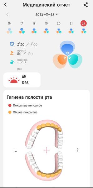 Зубная щетка Oclean X Ultra 20 S:, фото 24