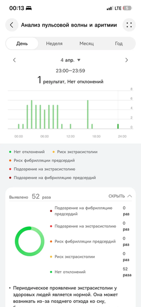 Умный браслет Huawei Band 11 Pro:, фото 17