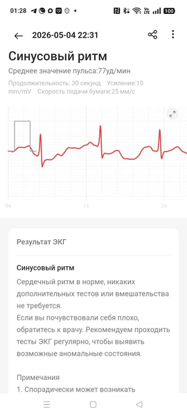 Умные часы OnePlus Watch 4:, фото 26