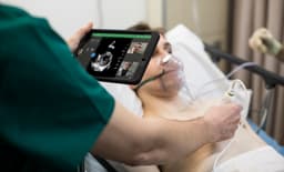 Philips Lumify превращает смартфон или планшет в прибор для медицинской ультразвуковой диагностики