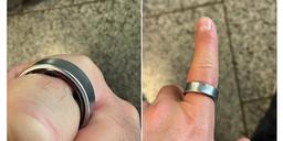 Аккумулятор Samsung Galaxy Ring вздулся, палец распух и застрял в кольце: чем всё закончилось