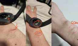 Умные часы Samsung Galaxy Watch 8 обожгли пользователя — Samsung не признала ответственность за инцидент
