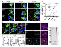 Учёные нашли механизм, из-за которого разрушаются клетки мозга при болезни Паркинсона