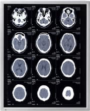 NEC LCD Technologies Announce New 19-Inch Monochrome LCD Module for Medical Use