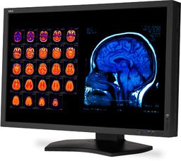 NEC Rolls Out 30-inch Widescreen LCD For Medical Diagnostics