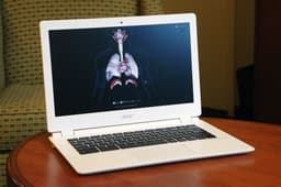 Мобильный ПК Acer Chromebook 13 (CB5-311-T7NN), основанный на SoC Tegra K1, оценён в $280