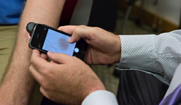iPhone поможет диагностировать рак на ранних стадиях
