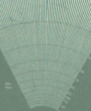 мира